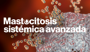 Mastocitosis