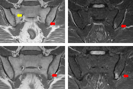 case001_answer_02_rev.png