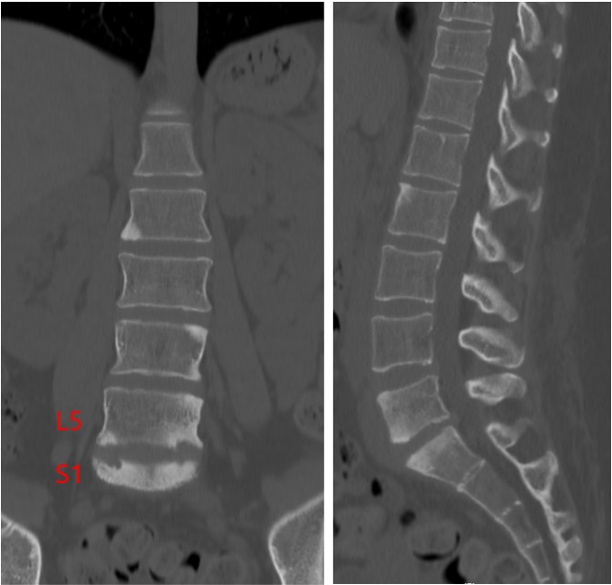 case004_01.jpg