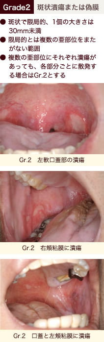 stomatitis_06.jpg