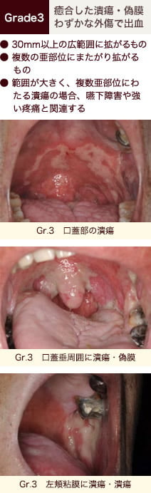 stomatitis_07.jpg