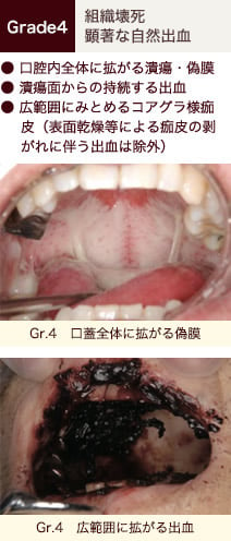 stomatitis_08.jpg